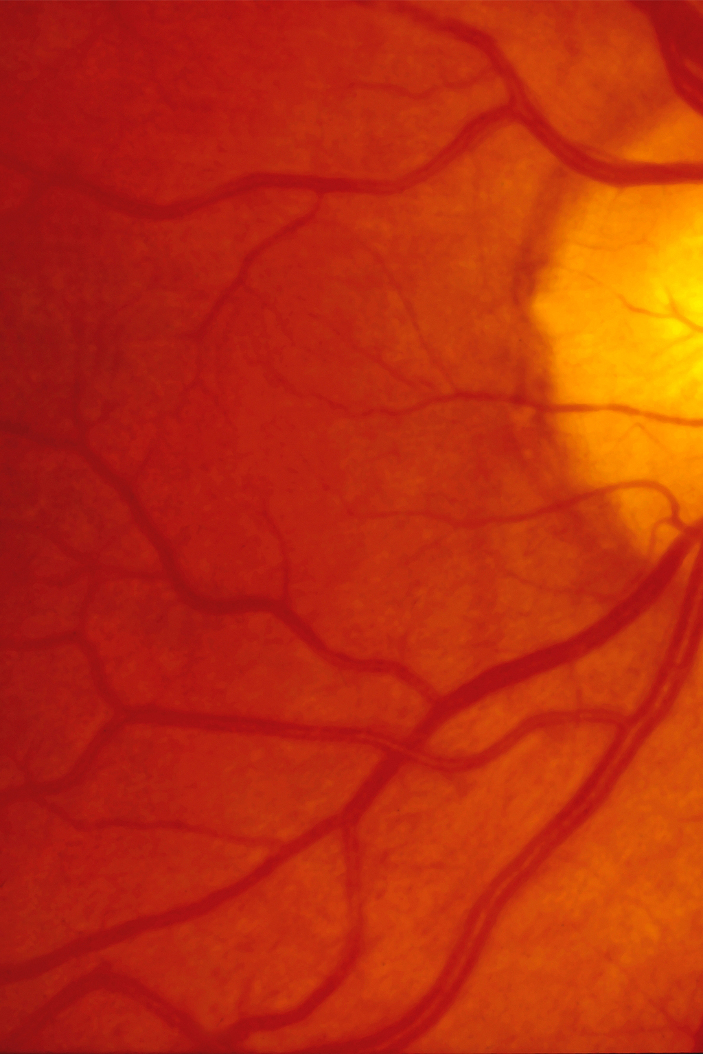 RETINA